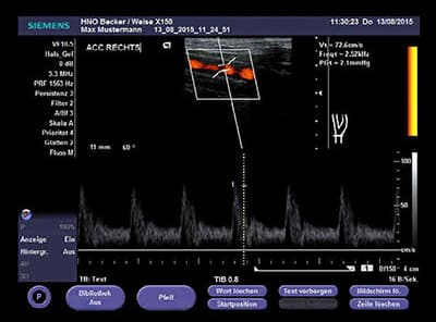 HNO Zentrum Hamburg Alstertal Doppler- und Farbdoppler-Untersuchungen